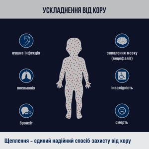 43в